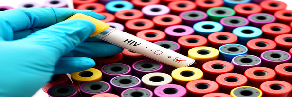 Test HIV NL