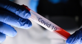 Depistage COVID-19 : Continuer à augmenter notre capacité technique de dépistage