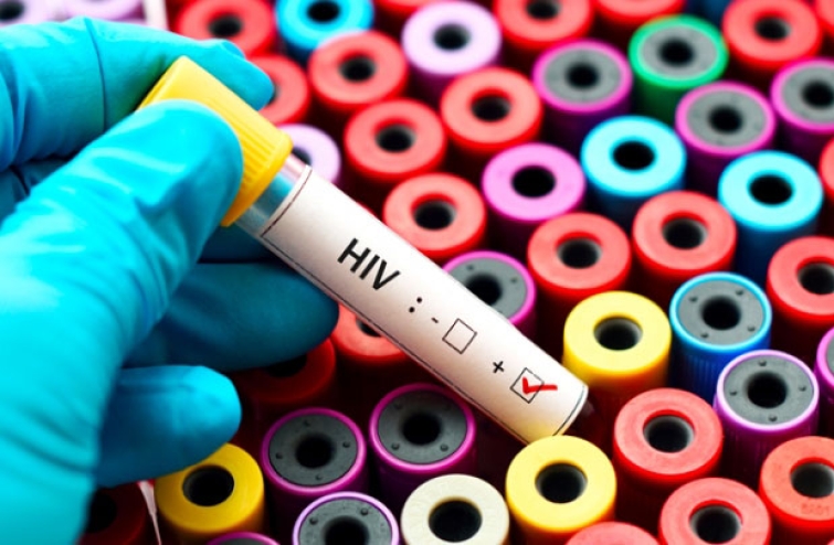 « VIH TEST » : Dépistage du VIH sans ordonnance : où en est-on ?