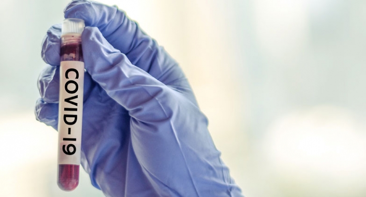 CNP-BM : Avis de synthèse sur les indications de réalisation des tests sérologiques