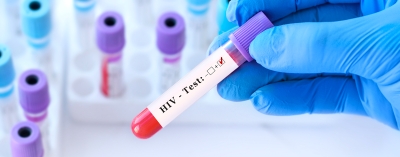 Journée mondiale de lutte contre le Sida  : Avec « Au Labo sans ordo », les biologistes  au cœur du dépistage du VIH
