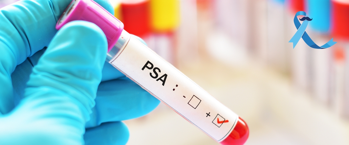 Movember. Les biologistes engagés pour la santé des hommes et en première ligne pour le dépistage du cancer de la prostate