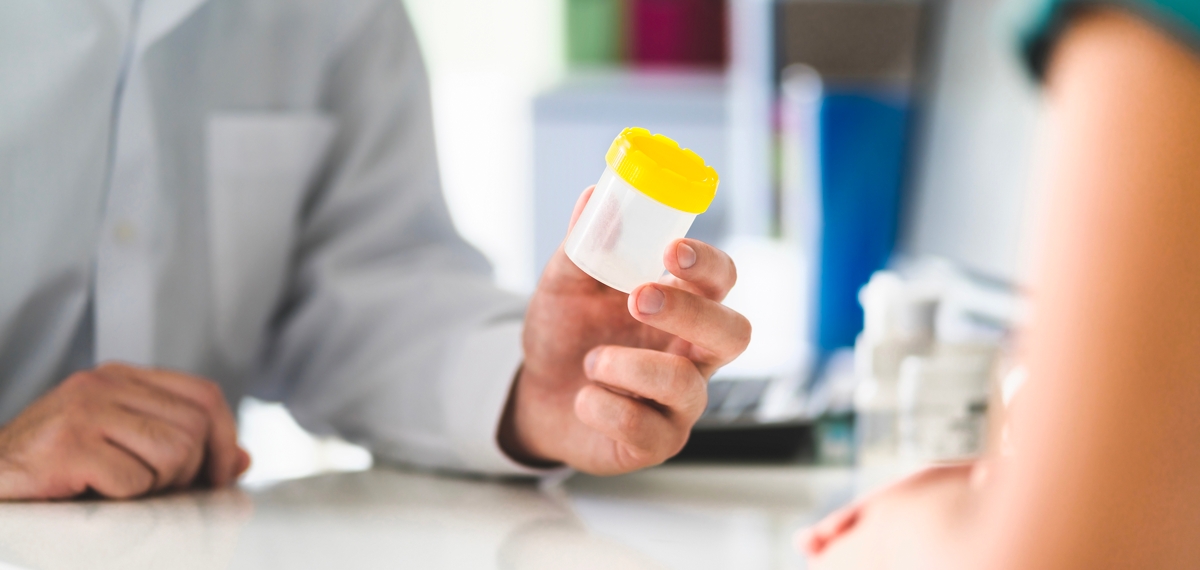 EBMD. Pour le SDBIO, l’avis de la HAS du 27 mars  sur la biologie délocalisée va dans le bon sens